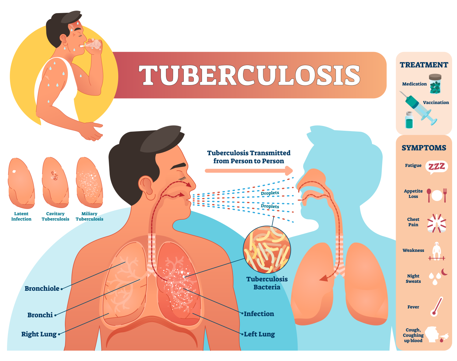 tuberculosis information