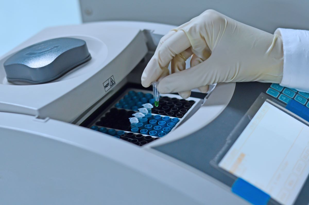 Polymerase chain reaction (PCR) test